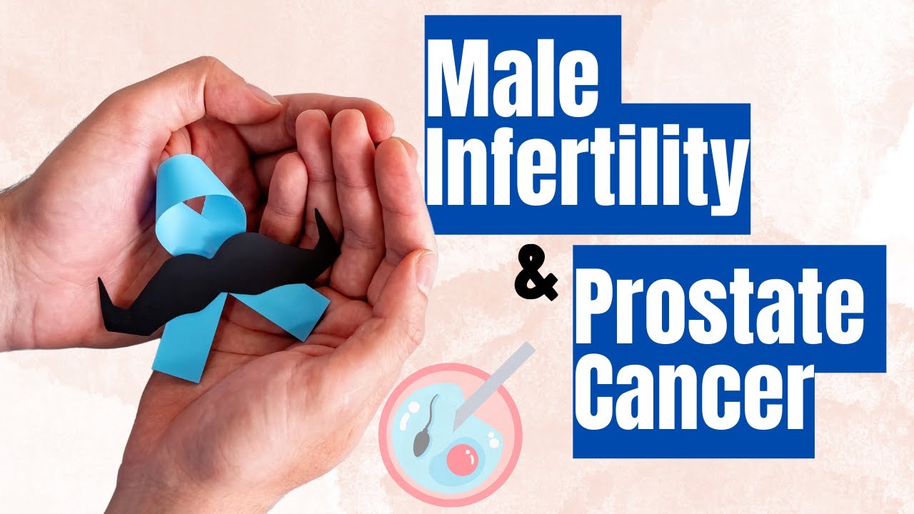 Link Between Male Infertility and Prostate Cancer: Expert Shares Insights and Tips for Men's Health