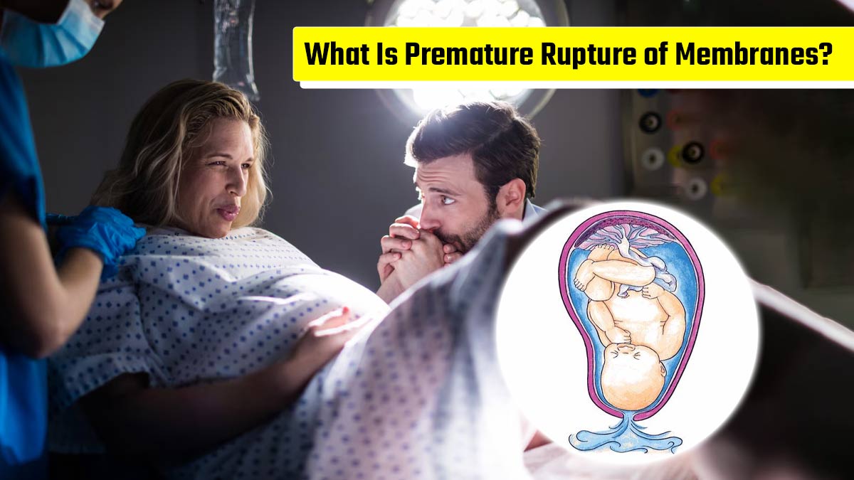 What Is Premature Rupture of Membranes (PROM)? Gynecologist Explains the Risks of Leaking Amniotic Fluid