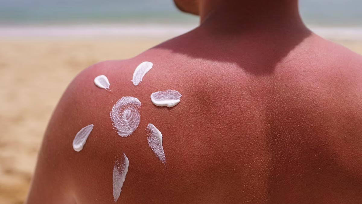 National Sunscreen Day 2025: What Is SPF And Should You Choose SPF 30 Or 50?