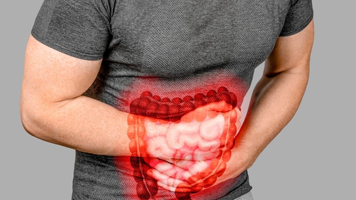 Can Tea And Coffee Trigger Irritable Bowel Syndrome (IBS)? Find Out From The Expert