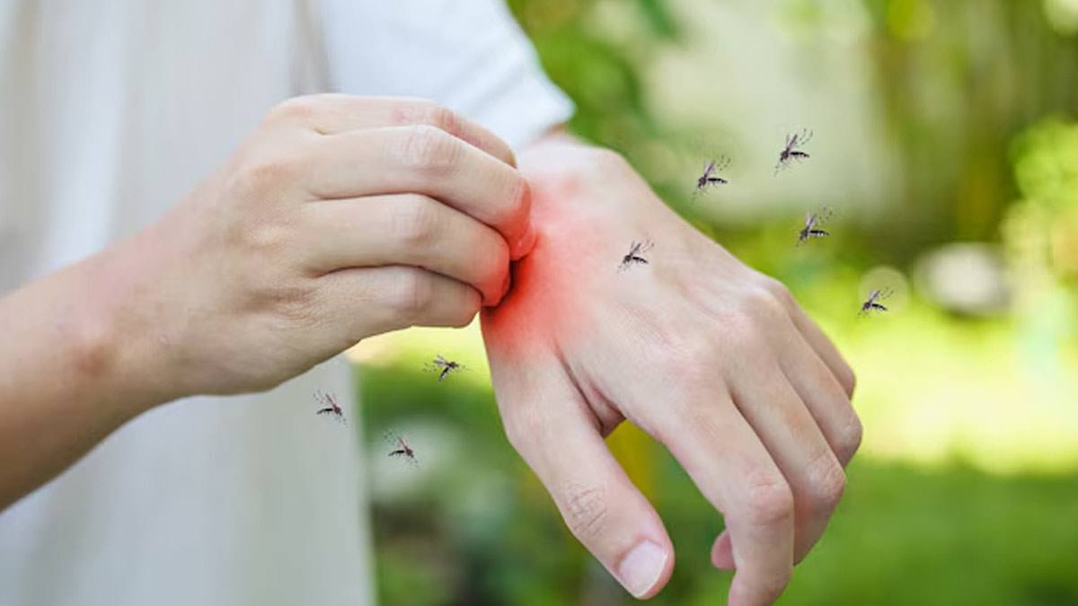 Boosting Immunity Naturally: Dietary Tips For Staying Healthy During Malaria Season