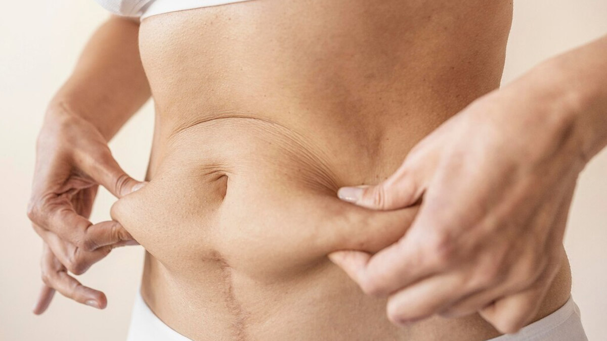 Celebrate Motherhood: Safe And Ethical Surgical Solutions For Post-Pregnancy Body Changes